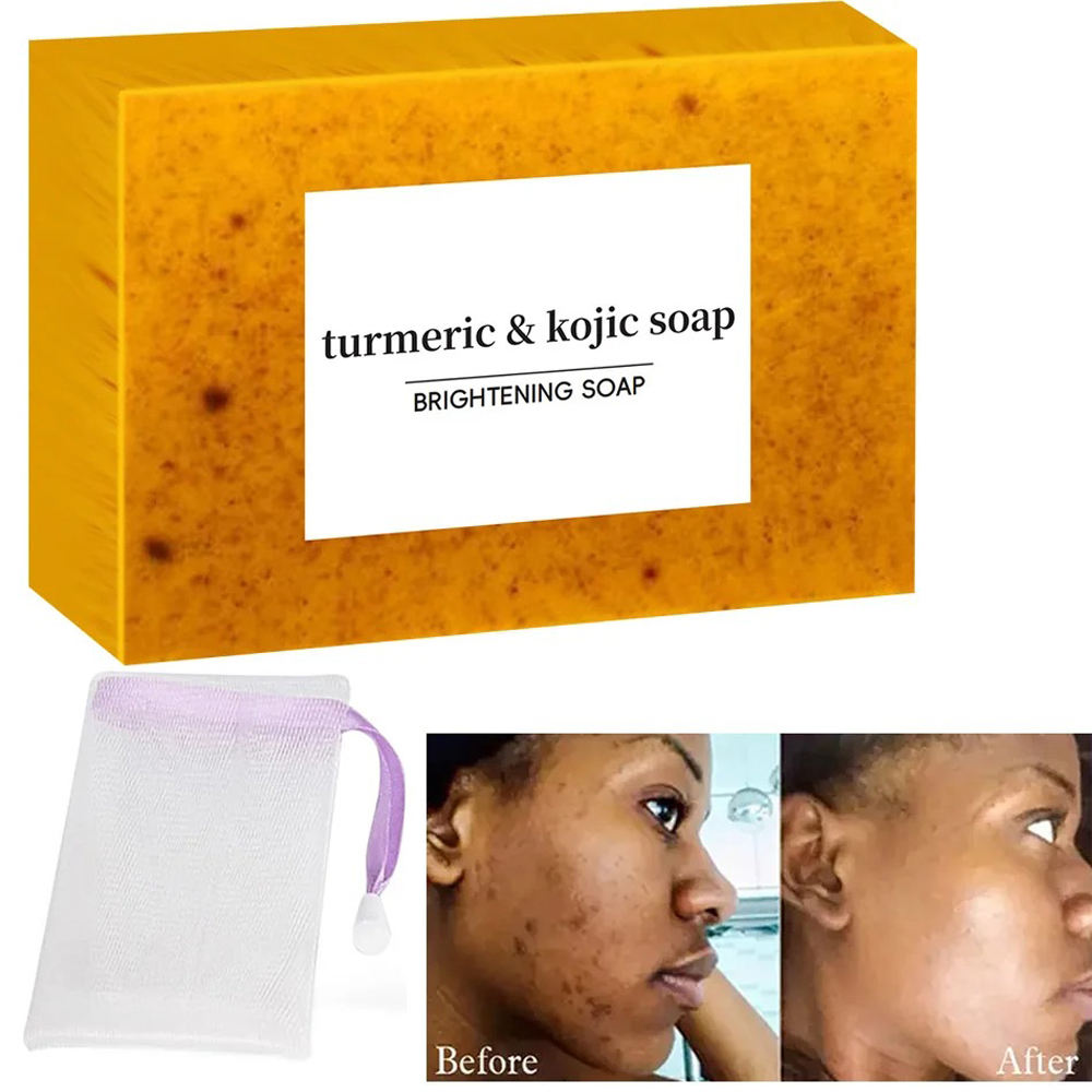 Dark‑Spot Correcting Soap – Kojic + Turmeric Cleanser